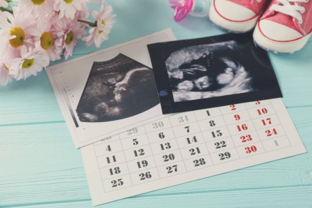 Baby waiting concept. Ultrasound photo and calendar on blue wooden background